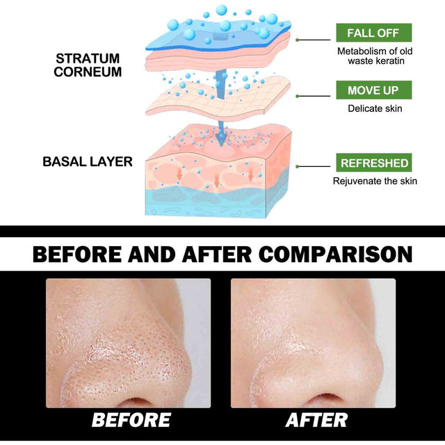 Lingouzi Blackhead Remover Mask, Bamboo Charcoal Peel off Face Mask, Deep Cleansing Black Mask Purifying Peel-Off Mask, Suction Blackhead Remover Mask