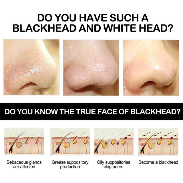 Lingouzi Blackhead Remover Mask, Bamboo Charcoal Peel off Face Mask, Deep Cleansing Black Mask Purifying Peel-Off Mask, Suction Blackhead Remover Mask