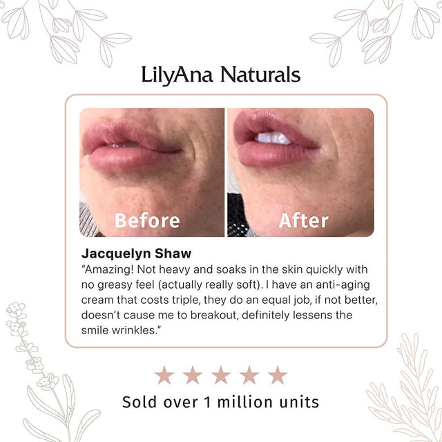 Lilyana Naturals Retinol Cream for Face - Retinol Cream, anti Aging Cream, Retinol Moisturizer for Face, Wrinkle Cream for Face, Retinol Complex - 1.7Oz