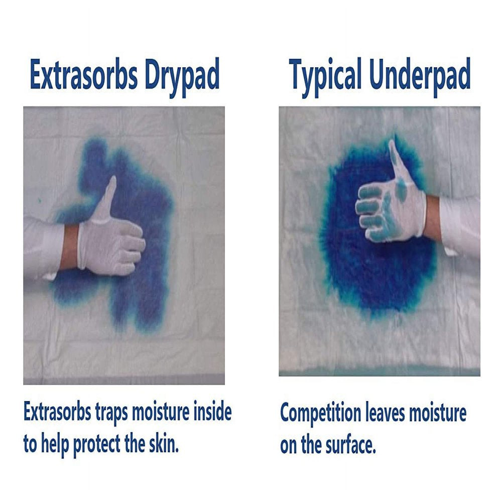 medline-ultrsorb3136-31-in-x-36-in-ultrasorbs-ap-underpads-white-10-pack-02-64acde4835f60c814ec98eb15d48af79.jpg