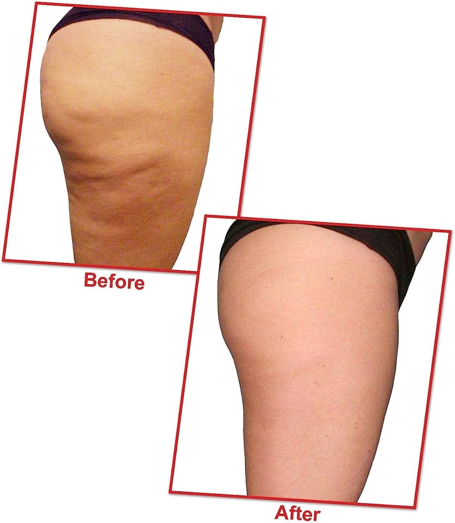 verem-lipolyzer-fat-burning-oil-weight-management-225-ml-03-08717b60afd1abf7c7f020ac6fa74b37_c9c28f7b-8a5c-4637-baef-ec80d251ac5c.jpg