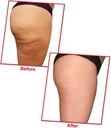 verem-lipolyzer-fat-burning-oil-weight-management-225-ml-03-08717b60afd1abf7c7f020ac6fa74b37_c9c28f7b-8a5c-4637-baef-ec80d251ac5c.jpg