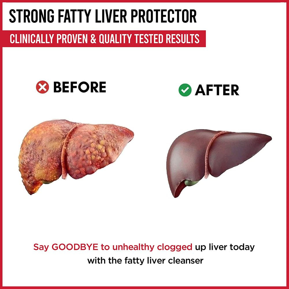 90-capsule-fatty-liver-detox-herbal-supplement-cleanse-artichoke-leaf-06-08e4ec10cb29b5c204aec4e43cb2cb4f.jpg