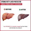 90-capsule-fatty-liver-detox-herbal-supplement-cleanse-artichoke-leaf-06-08e4ec10cb29b5c204aec4e43cb2cb4f.jpg