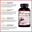 90-capsule-fatty-liver-detox-herbal-supplement-cleanse-artichoke-leaf-08-fa0880d1fc4c09d3e7d76eab00dd8e95.jpg