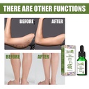 thin-stomach-slimming-oil-let-body-sexy-oil-abdominal-essential-oil-relieving-constipation-massage-oil-for-slimming-fat-burning-04-3018b5049363d0434732bdc14e4adab2.jpg